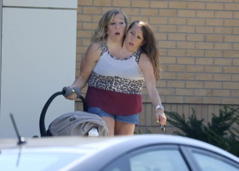 Сіамські близнючки Еббі та Бріттані вперше стали мамами - ЗМІ