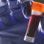 Вчені виявили зв’язок між групою крові та ризиком діабету 2 типу