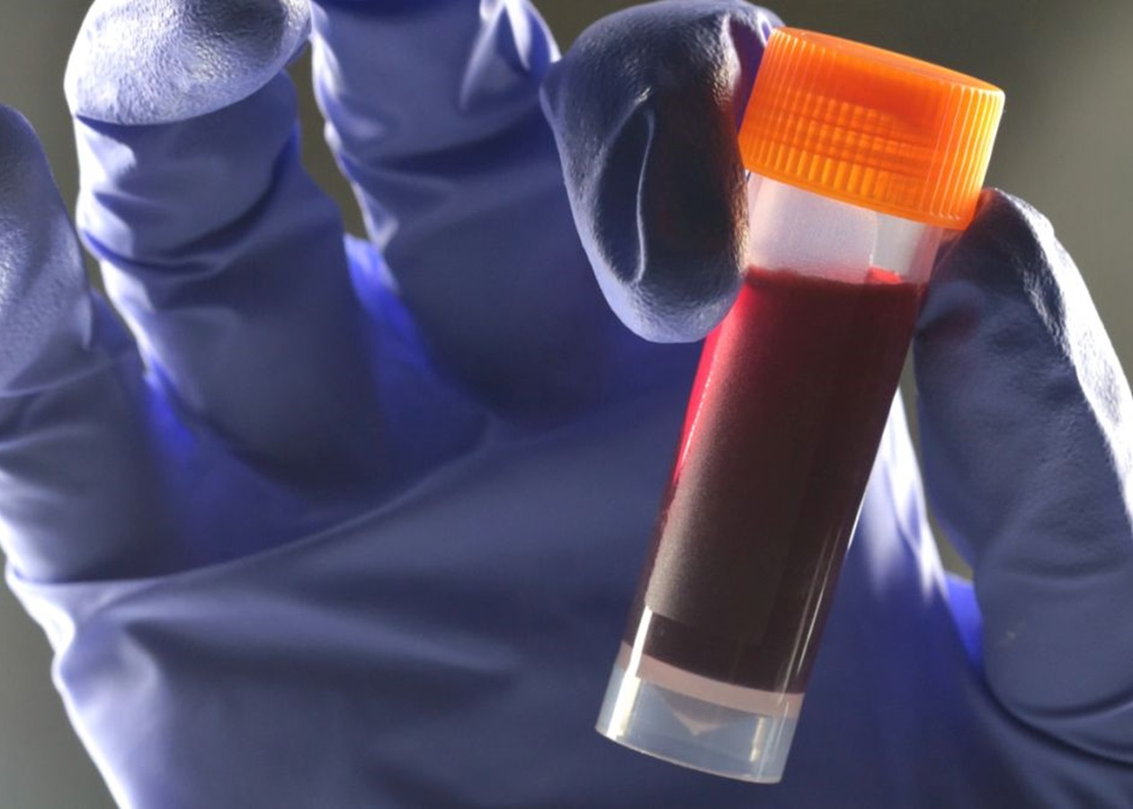 Вчені виявили зв’язок між групою крові та ризиком діабету 2 типу