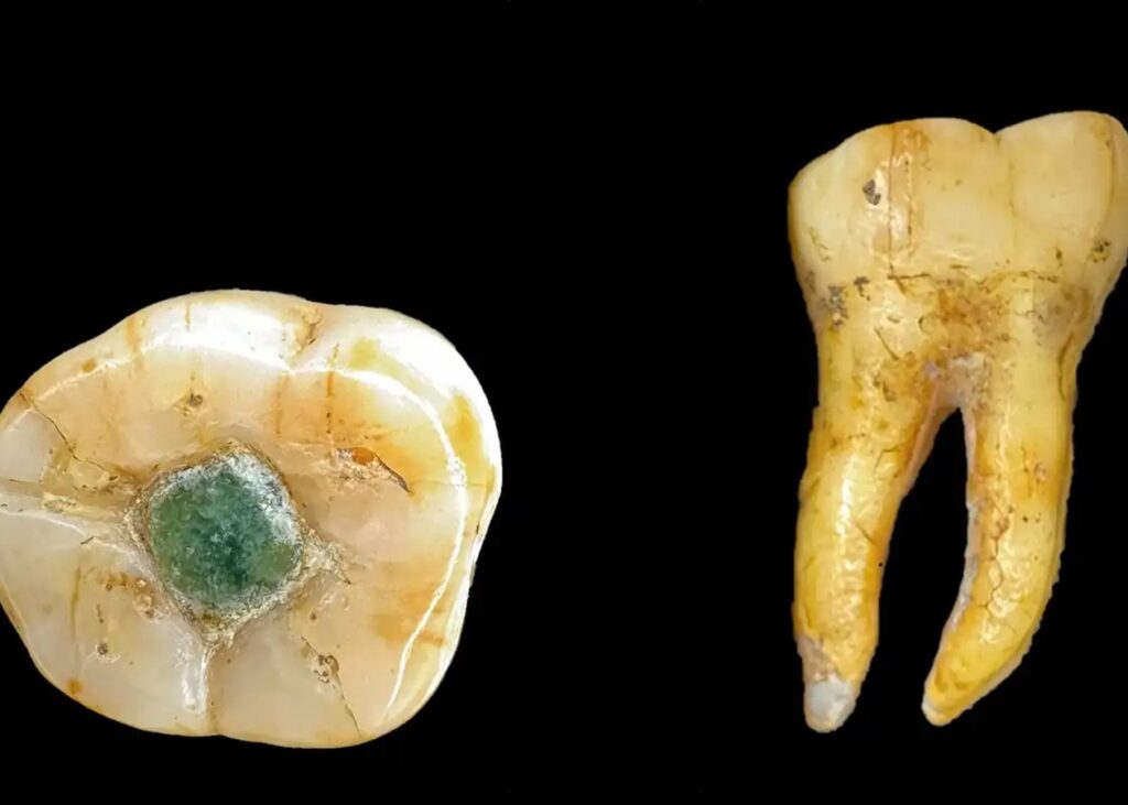 Давні мая використовували дорогоцінні камені як пломби