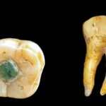 Давні мая використовували дорогоцінні камені як пломби